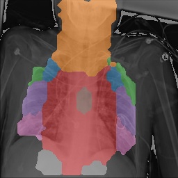 Chest X-Ray Part Map