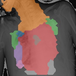 Chest X-Ray Part Map