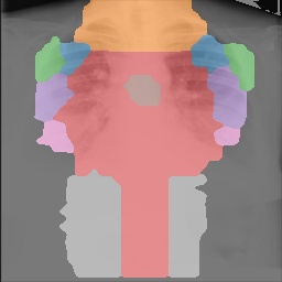 Chest X-Ray Part Map