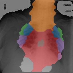 Chest X-Ray Part Map