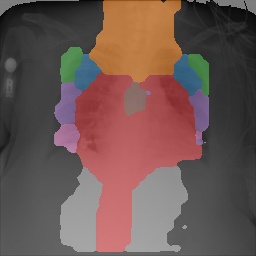 Chest X-Ray Part Map
