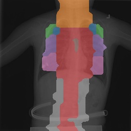 Chest X-Ray Part Map