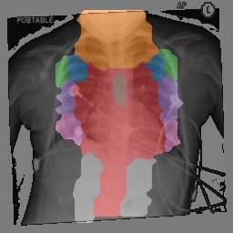 Chest X-Ray Part Map