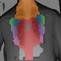 Chest X-Ray Part Map