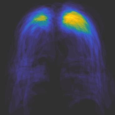 GT Pneumothorax Heatmap